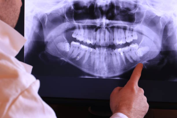 Best Emergency Gum Pain Relief  in Brooklet, GA