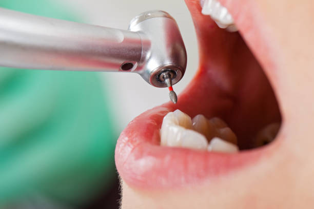 Best Tooth Pain Emergency Relief  in Brooklet, GA